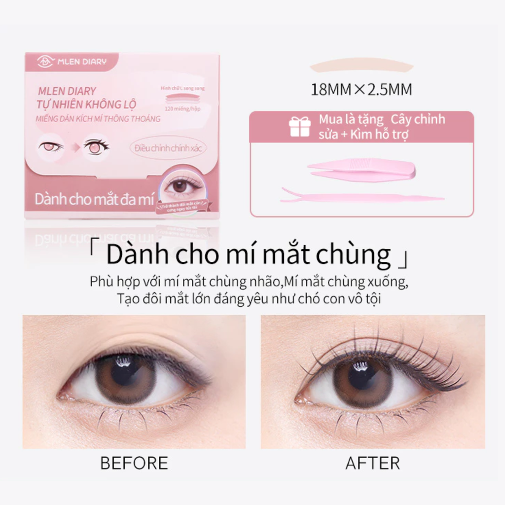 Kích Mí Dáng Chữ L Mlen Diary