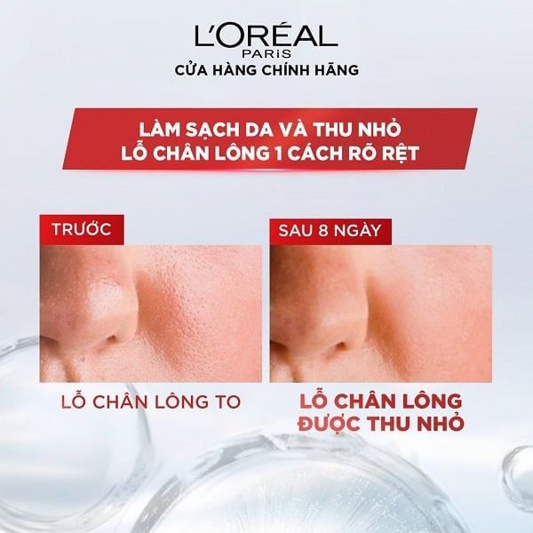 Nước Tẩy Trang Loreal Cho Da Dầu Revitalift Crystal Purifying Micellar Water