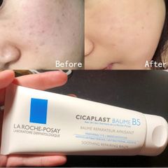 Kem Dưỡng Phục Hồi Da La Roche Posay Cicaplast Baumel B5 Soothing Repairing