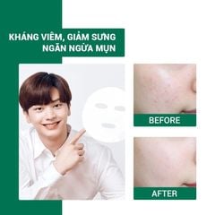 Mặt Nạ Làm Dịu Da Giảm Mụn Some By Mi Tea Tree Calming Sheet Mask 25g