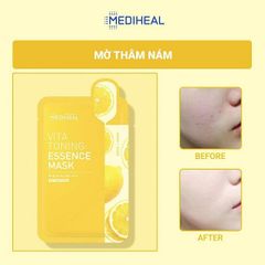 Mặt Nạ Mediheal Ampoule/Essence/Water Mask 20ml