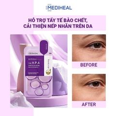 Mặt Nạ Mediheal The Ampoule Mask