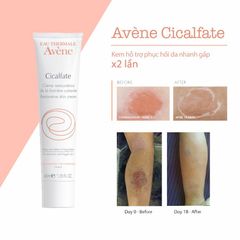 Kem Dưỡng Hỗ Trợ Phục Hồi Da Lành Sẹo Avene Cicalfate Cream