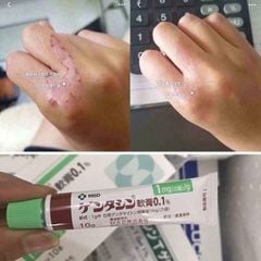 Kem Trị Sẹo Dạng Gel Gentacin Ointment 0.1% Nhật Bản 10g