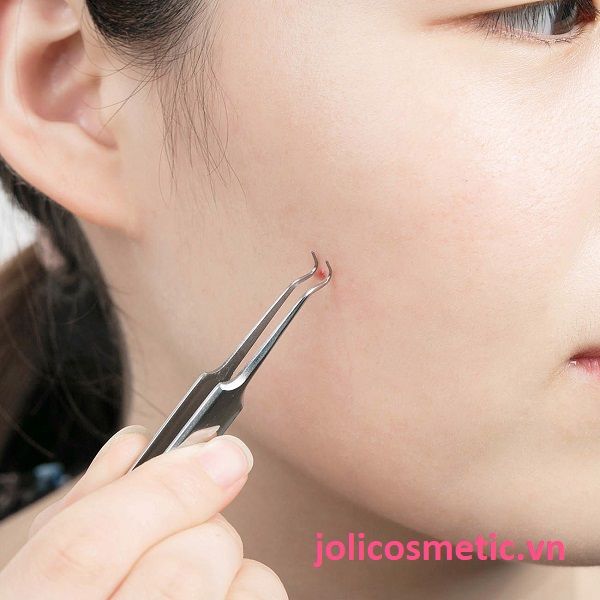 Nhíp Lấy Mụn Vacosi Blackhead Tweezers T07