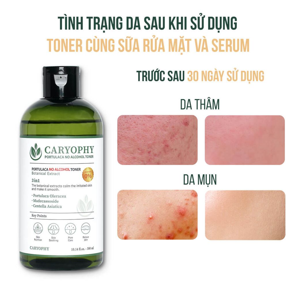 Nước Hoa Hồng Ngừa Mụn Kiềm Dầu Giảm Thâm Caryophy Portulaca Toner 300ml