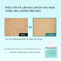 Nước Hoa Hồng Dạng Miếng Mediheal Toner Pad 170ml