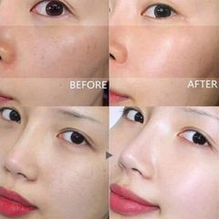 Tinh Chất Dưỡng Trắng Trị Nám Dongsung Rannce Serum 45ml