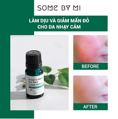 Tinh Dầu Tràm Trà Làm Giảm Mụn Some By Mi 30 Days Miracle Tea Tree Clear Spot Oil 10ml