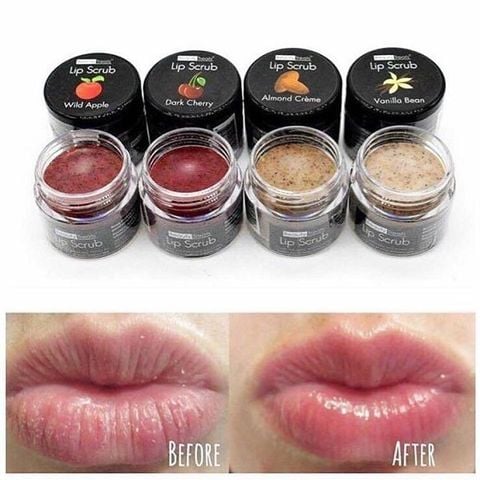 Tẩy Tế Bào Chết Môi Beauty Treats Lip Scrub