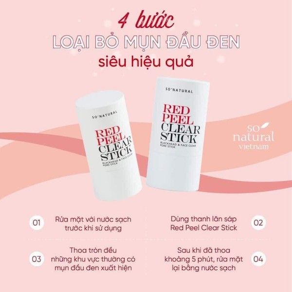 Thanh Lăn Mụn So Natural Red Peel Clear Stick 23g