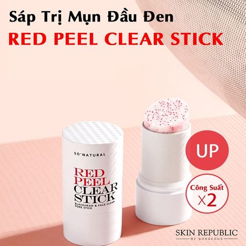 Thanh Lăn Mụn So Natural Red Peel Clear Stick 23g
