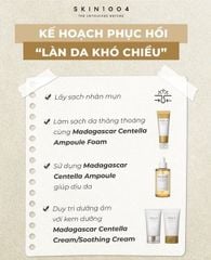 Tinh Chất Rau Má Giảm Mụn Phục Hồi Da Skin1004 Madagascar Centella Ampoule