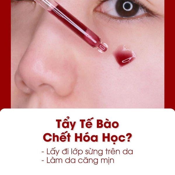 Tinh Chất Tẩy Da Chết Hóa Học So Natural Red Peel Tingle Serum