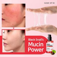 Tinh Chất Phục Hồi Da Mờ Thâm Sẹo Some By Mi Snail Truecica Miracle Repair Serum 50ml