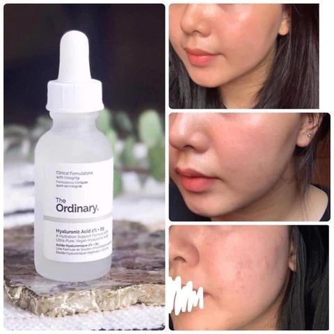 Tinh Chất Phục Hồi DaThe Ordinary Hyaluronic 2%+ B5 30ml