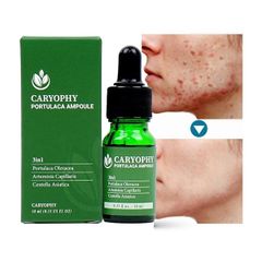 Serum Caryophy Giảm Mụn Mờ Thâm Se Lỗ Chân Lông Portulaca Ampoule 10ml