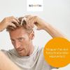 Thuốc xịt chống rụng kích thích mọc tóc nam Bio H-TIN Minoxidil