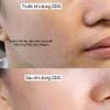 Serum sụn mũi cá hồi DDS 48 viên