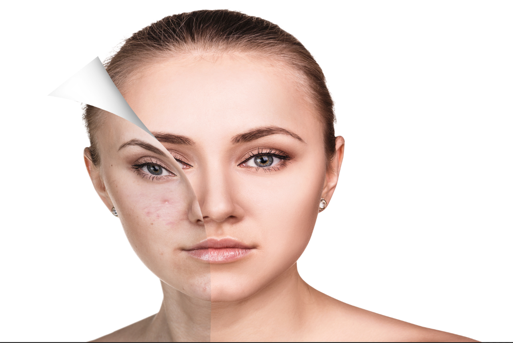 TRANH TREO TƯỜNG KHUNG HỢP KIM - TRANH SPA - MÃ T3D-1942