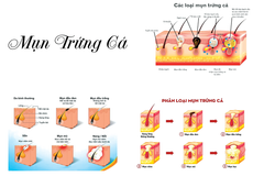 TRANH TREO TƯỜNG KHUNG HỢP KIM - TRANH SPA - MÃ T3D-3899