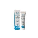 ACNE QUEEN CREAM (Tuýp 20ml) - Hỗ Trợ Điều Trị Da Dầu Và Mụn Trứng Cá