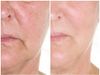 Tái tạo làn da mới siêu đẵng cấp doterra Reveal Facial System (CSD03)