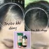 Bộ gội xả gừng tươi Weilaiya mẫu mới Wei03