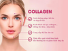 Viên uống Collagen thuỷ phân Myvitamins Giúp giảm thâm, nám , tàn nhang (Pháp) HOT210