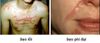Bộ sản phẩm xóa mờ sẹo Scar Heal Kit Plus (RJ02)