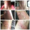 Thuốc mỡ sơ cứu đa năng - khi da bạn bị tổn thương, điều chỉnh phục hồi các vết thương Correct-X® (CSCT05)
