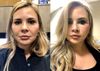 Tái tạo làn da mới siêu đẵng cấp doterra Reveal Facial System (CSD03)