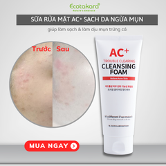 Sữa rửa mặt cho da dầu mụn AC+ Hàn Quốc (150ml) giúp đánh bay bụi bẩn, kiểm soát bã nhờn và làm giảm mụn hiệu quả {Có tem phụ nhập khẩu chính ngạch}