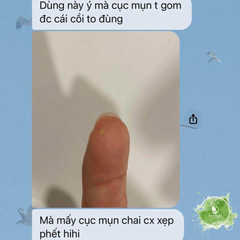Kem giảm mụn, mờ thâm mụn AC+ Hàn Quốc (60ml) {Có tem phụ nhập khẩu chính ngạch}
