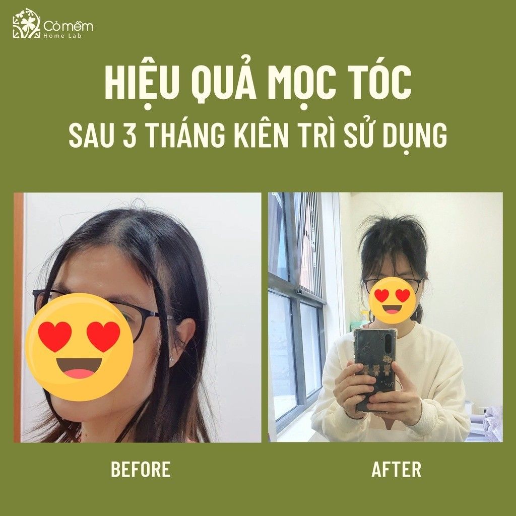 Serum Tóc Mây Cỏ Mềm 50ml dưỡng tóc suôn mượt, giảm rụng tóc, kích thích mọc tóc