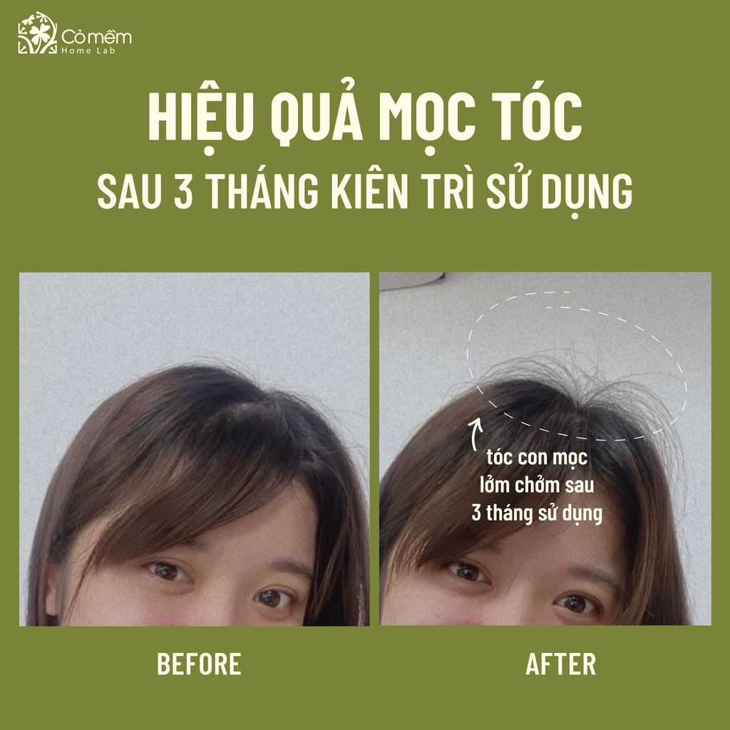 Serum Tóc Mây Cỏ Mềm 50ml dưỡng tóc suôn mượt, giảm rụng tóc, kích thích mọc tóc
