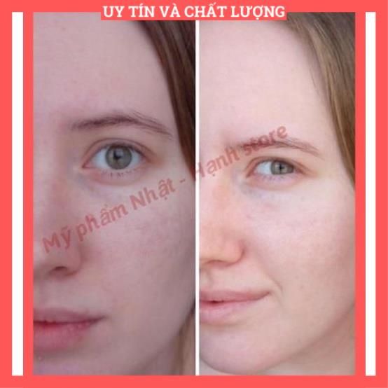 50 - Nước Hoa Hồng Làm Sạch Milenium Avanced Daily Treatment Lotion - Holy Land