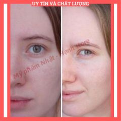 50 - Nước Hoa Hồng Làm Sạch Milenium Avanced Daily Treatment Lotion - Holy Land