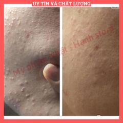 50 - Nước Hoa Hồng Làm Sạch Milenium Avanced Daily Treatment Lotion - Holy Land