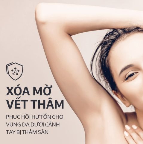  Lăn Khử Mùi – Trắng Mịn – Ngọt Ngào M.pros 