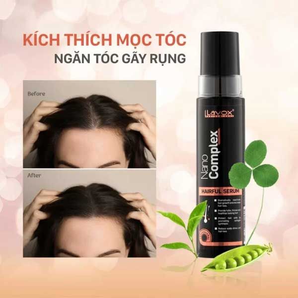  Serum Hỗ Trợ Mọc Tóc Lavox Nanocomplex 