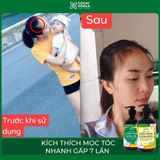 DẦU GỘI XẢ GỪNG DỪA HỮU CƠ - KÍCH THÍCH MỌC TÓC, DƯỠNG TÓC MỀM MƯỢT