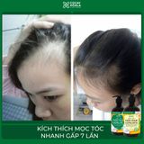 DẦU GỘI XẢ GỪNG DỪA HỮU CƠ - KÍCH THÍCH MỌC TÓC, DƯỠNG TÓC MỀM MƯỢT