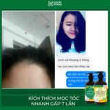 DẦU GỘI XẢ GỪNG DỪA HỮU CƠ - KÍCH THÍCH MỌC TÓC, DƯỠNG TÓC MỀM MƯỢT