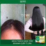 DẦU GỘI XẢ GỪNG DỪA HỮU CƠ - KÍCH THÍCH MỌC TÓC, DƯỠNG TÓC MỀM MƯỢT