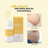 GEL NGỪA RẠN NGHỆ