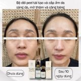  B57 COPPER PEPTIDE  SERUM- Serum đa Peptide cấp ẩm, chống lão hóa, phục hồi, làm dịu và hỗ trợ đầy sẹo 