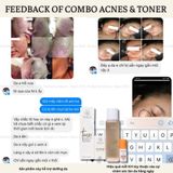  HERBAL TONER - Toner thảo dược 