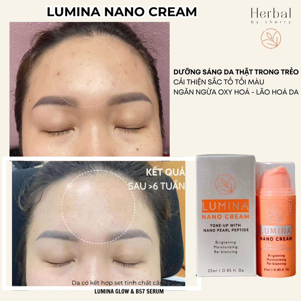  LUMINA NANO CREAM - Kem dưỡng sáng da Nano Lumina 