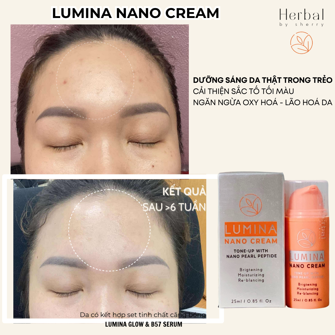  LUMINA NANO CREAM - Kem dưỡng sáng da Nano Lumina 